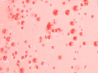 Researchers investigated whether SARS-CoV-2 components could cross the placental barrier and interact with fetal immune cells