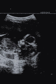 Infanticide, cover