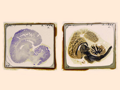 Diapositivas de tejido cerebral «Delfín 1» del Morgane Project, 1967, Icahn School of Medicine, Mount Sinai