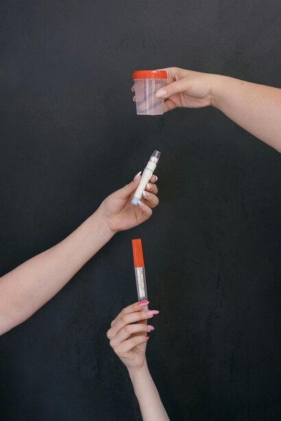 Aunque la ley prohíbe la venta de fluidos humanos, la transformación industrial de la orina permite que se convierta en insumo clave de tratamientos millonarios