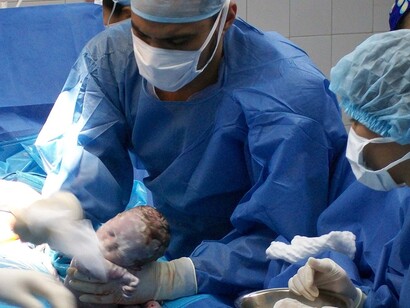 Cirujanos practicando un parto por cesárea