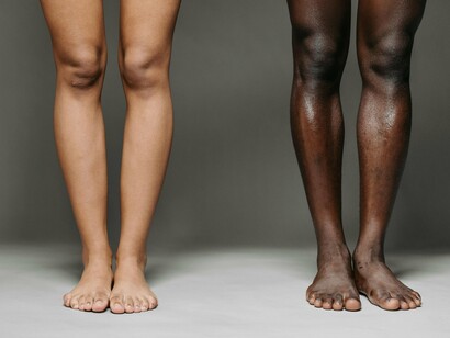 Pernas de pessoas diferentes lado a lado. No passado, nos comparávamos com nossos vizinhos, que também estudavam na mesma escola que nós; nos comparavámos com os amigos das atividades extracurriculares, familiares e conhecidos