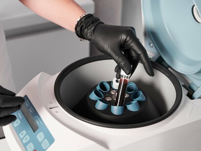 A technician prepares a blood sample for centrifugation, the key step in isolating platelet-rich plasma (PRP)