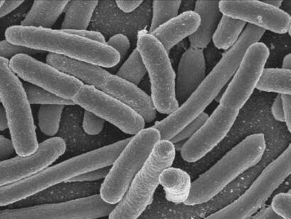 Bacteria seen through a microscope