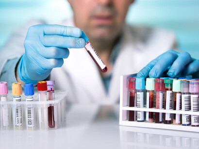 Esami di laboratorio