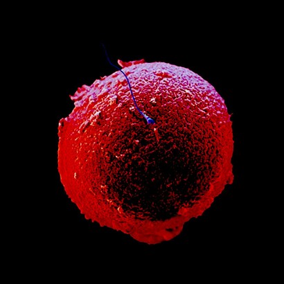 En un instante... la vida