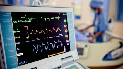 Diagnosticare l’anemia con l’elettrocardiogramma
