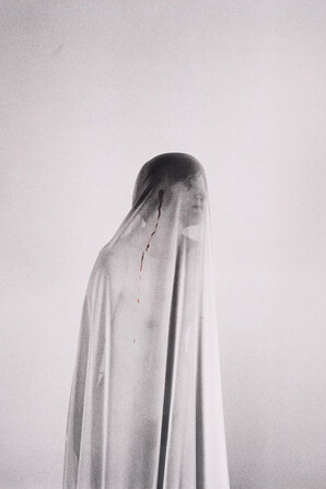 Show Me Your wound. Courtesy of Dom Museum Wien 