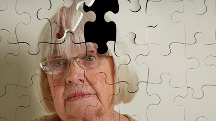 Una mujer a la que le falta una pieza en su cabeza