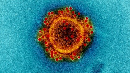 Imagen ampliada y coloreada digitalmente de un virión de una cepa de coronavirus (MERS-CoV)