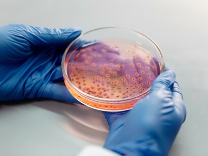 A person wearing gloves looking at bacteria on an agar plate 