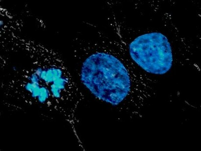 Células cancerígenas