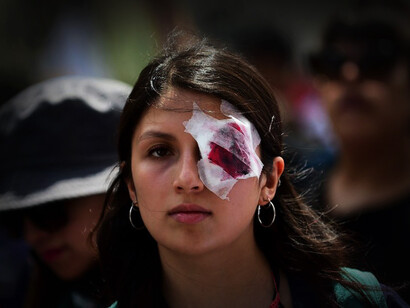 Mujer se cubre un ojo en señal de protesta en Santiago de Chile