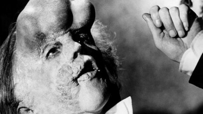 The Elephant Man di David Lynch,1980. In scena John Hunt