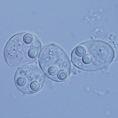 Myxozoa al microscopio