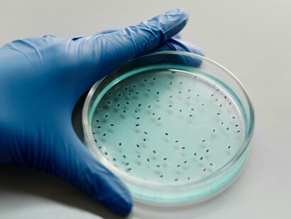 Cultured bacteria spreading across petri dish, symbolising the ecosystem of the human gut