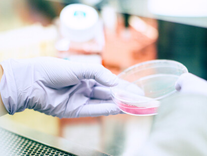 Public health measures in tuberculosis 