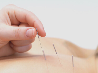Acupuncture therapy can help people of all ages
