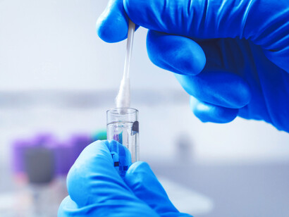 Los investigadores utilizaron sus hallazgos para comparar la COVID-19 con otras enfermedades y también con datos de personas sanas