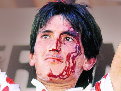 Luis Alberto Herrera, después de una estrepitosa caída, ganó la etapa reina del tour de Francia con la cara ensangrentada