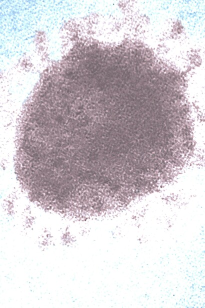 Imagen microscópica electrónica de transmisión (TEM) tomada en 1975: representa un virión del virus de la bronquitis infecciosa aviar (IBV), miembro de la familia Coronaviridae 