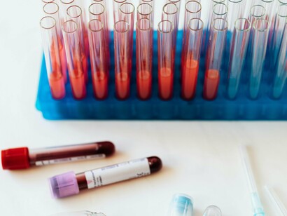 Tubos de ensaio com amostras de sangue. Se pode tomar café, chá, suco, chimarrão, isotônicos, água de coco, etc. Infelizmente há pessoas que vão em jejum e se sentem mal durante a doação, o que faz com que não voltem: e com isso o mito se propaga