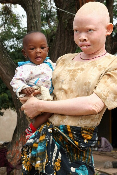 Familias con miembros albinos
