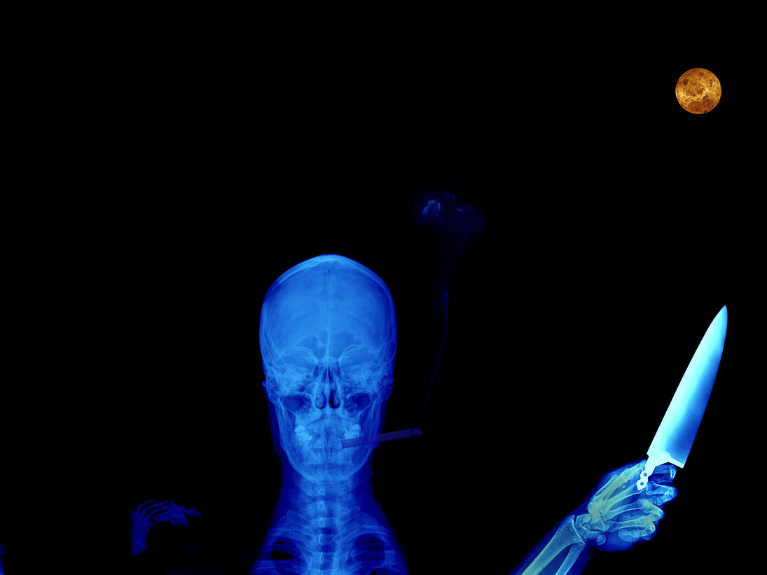 Alexander de Cadenet, The Candle that Burns Twice as Bright... (detail), 2011