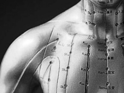  Chinese Medicine