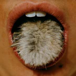 Bady Minck, La belle est la bête (Beauty is the beast, still), 2005. Courtesy of the Henry Moore Foundation