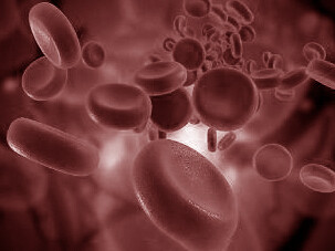 I sintomi dell'anemia sono spesso vaghi e la diagnosi è spesso effettuata in fase avanzata