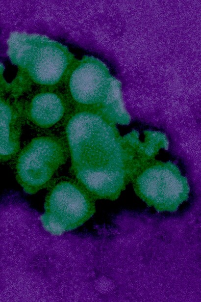 Imagen de microscopio electrónico de transmisión (TEM) coloreada digitalmente de la morfología ultraestructural de un virus (gripe porcina) 