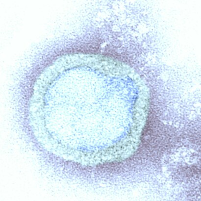 Imagen microscópica electrónica de transmisión (TEM): representa un virión del virus de la gripe A