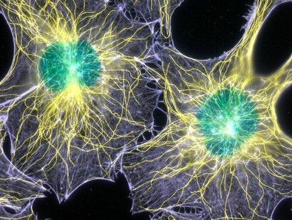 Fibroblasti al microscopio