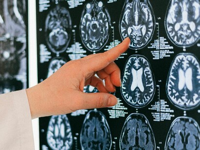 Es urgente legislar neuroderechos para proteger la identidad humana frente a la integración digital