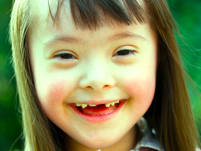 Niña con síndrome de Down