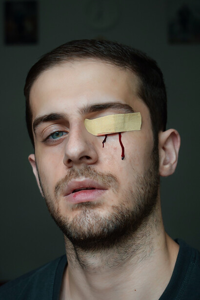 Depicting domestic violence against men, symbolized by a man wearing a brown band-aid on his eye