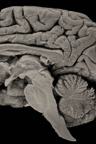 Lo más relevante para la transformación del funcionamiento del cerebro, no es el número, es la complejidad dada por las conexiones que se establecen entre las distintas partes del encéfalo