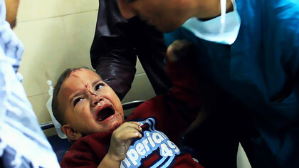 Boy injured at Shifaa Hospital, Gaza, Palestine