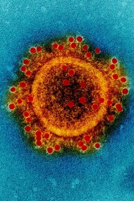 Imagen ampliada y coloreada digitalmente de un virión de una cepa de coronavirus (MERS-CoV)