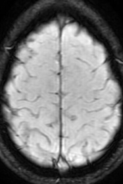 Resonancia magnética del cerebro humano