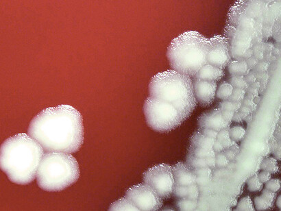 Cultivo de «Bacillus anthracis», causante del carbunco