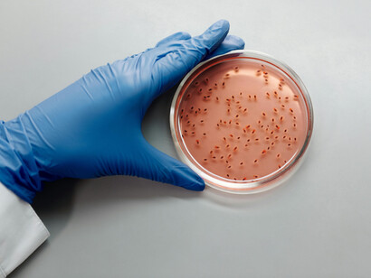 A human hand in latex gloves handling a sample