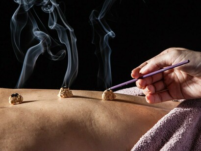 Bian Que and the Traditional Chinese Medicine: Moxibustion 