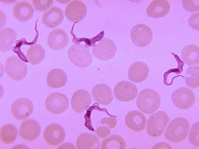 Tripanosomas de la enfermedad del sueño