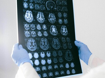 El uso comercial plantea riesgos graves sobre la privacidad mental y la desigualdad biológica