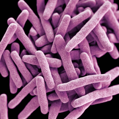 «Mycobacterium tuberculosis» o bacilo de Koch, agente causal de la mayor cantidad de los casos de tuberculosis