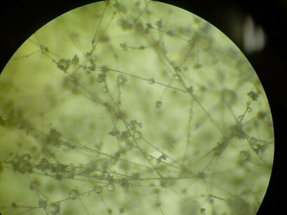 A microscopic view of Botrytis conidiophores