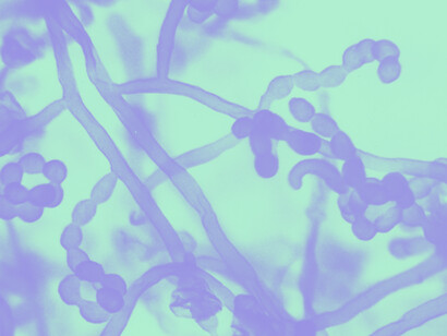 «Streptomyces griseus» bajo el microscopio