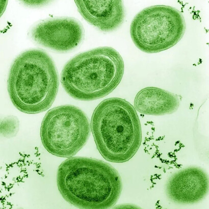 Cianobatteri modificati geneticamente: Il futuro della produzione alimentare?